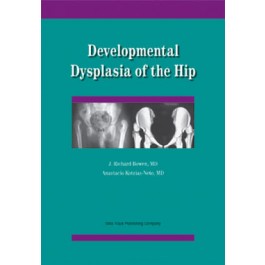 Developmental Dysplasia of the Hip