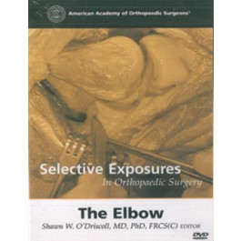 Selective Exposures in Orthopaedic Surgery: The Elbow